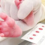 tamizaje neonatal